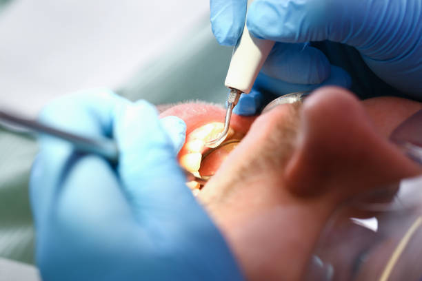 Best Tooth Infection Emergency Dentist  in Creedmoor, NC