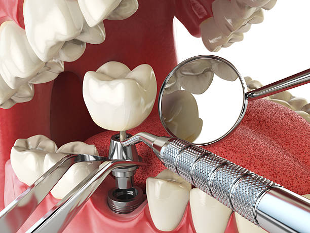 Best Root Canal Emergency Dentist  in Creedmoor, NC